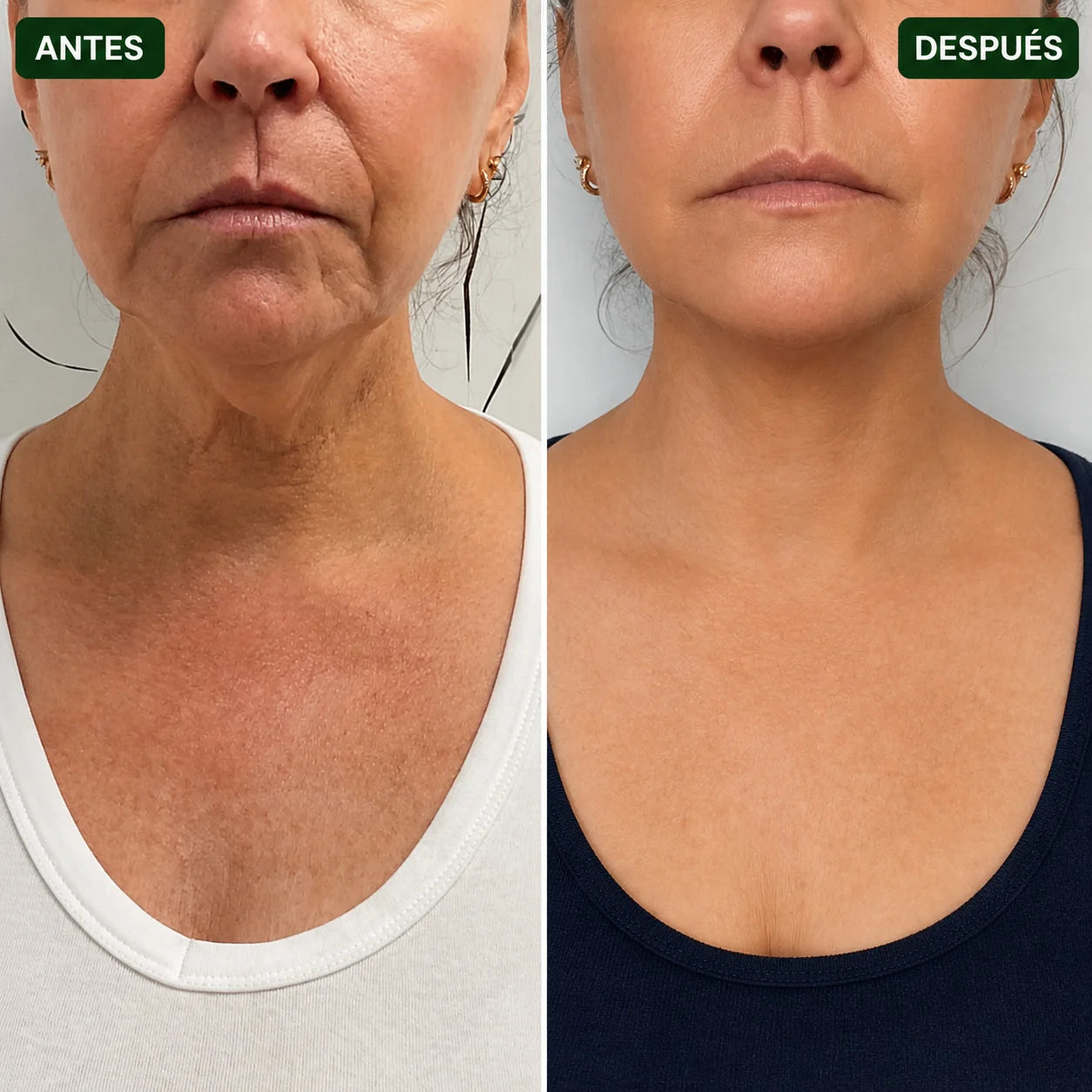 TiroClear® | Activador Tiroideo™ en gotas para tu tiroides