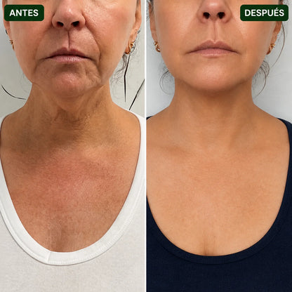 TiroClear® | Activador Tiroideo™ en gotas para tu tiroides