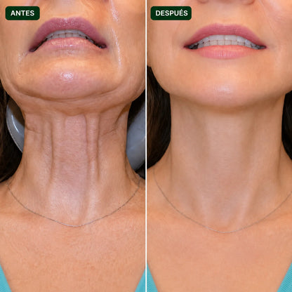 TiroClear® | Activador Tiroideo™ en gotas para tu tiroides